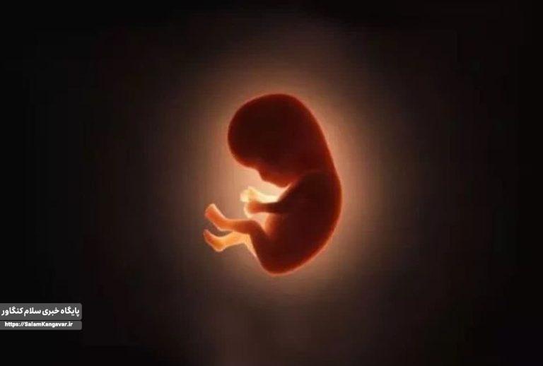 ضرورت تغییر نگرش درباره سقط جنین تعمدی