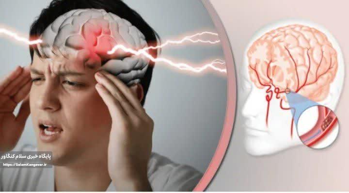 ۸۰درصد ازسکتههای مغزی قابل پیشگیری هستند