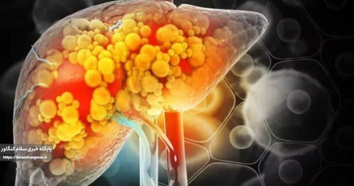 گیاهان دارویی در درمان کبد چرب موثرند؟