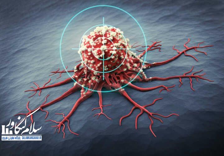 شیوع بالای سرطانهای گوارش و پستان در کرمانشاه